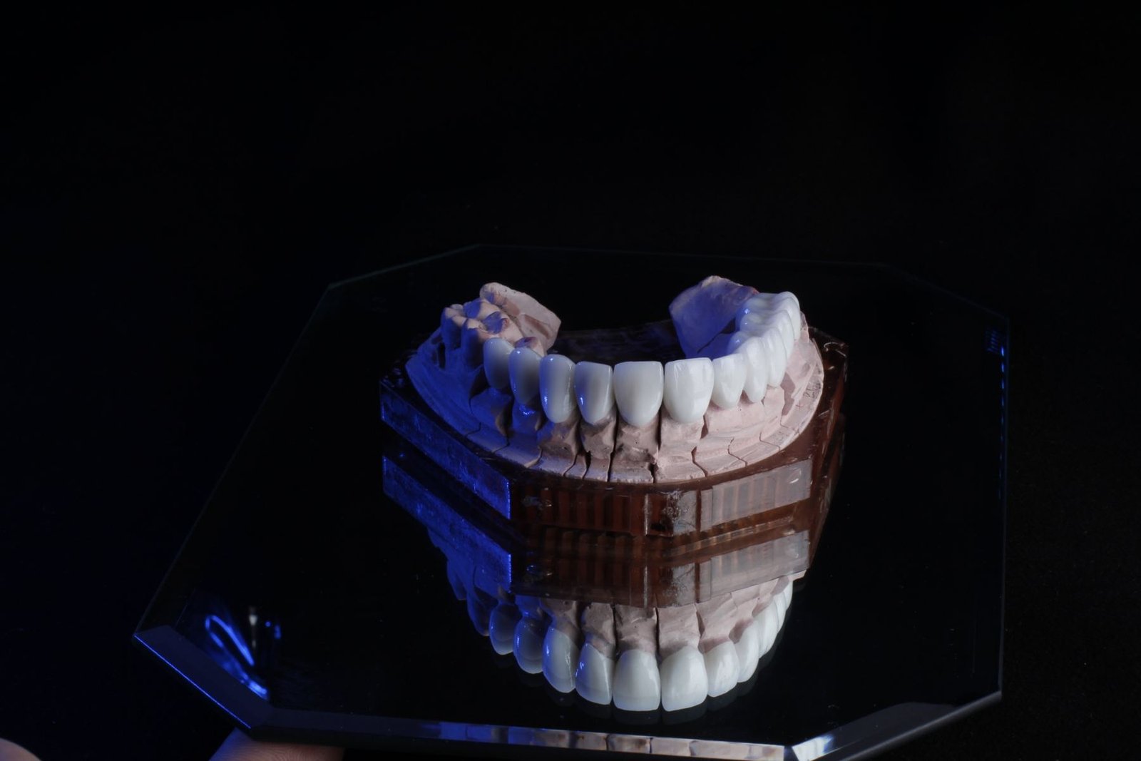 Prótesis dental terminada