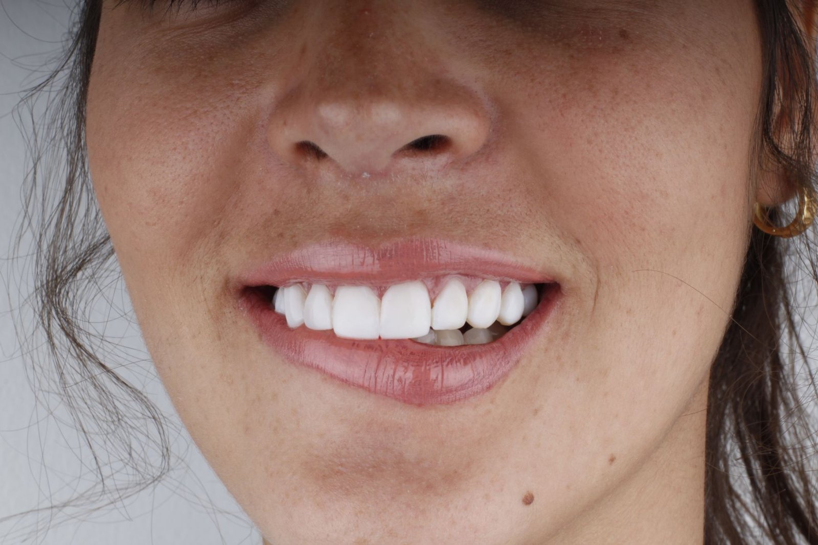Sonrisa blanca y natural