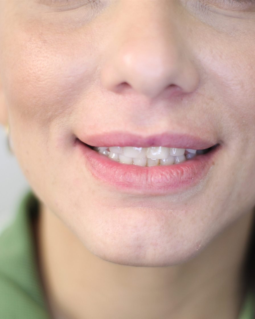 Sonrisa de una paciente de Servicios Dentales Hispanos