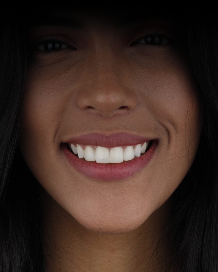 Sonrisa de una paciente de Servicios Dentales Hispanos